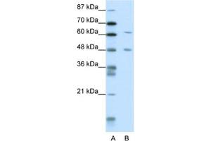 Western Blotting (WB) image for anti-NGFI-A Binding Protein 2 (EGR1 Binding Protein 2) (NAB2) antibody (ABIN2461773) (NAB2 抗体)