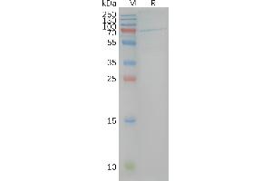 Human CB1-Nanodisc, Flag Tag on SDS-PAGE (CNR1 蛋白)