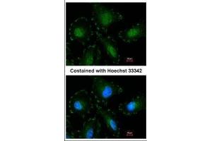 ICC/IF Image Immunofluorescence analysis of paraformaldehyde-fixed HeLa, using Calpain-5, antibody at 1:100 dilution. (Calpain 5 抗体)