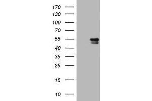 Image no. 1 for anti-Vimentin (VIM) antibody (ABIN1501720) (Vimentin 抗体)