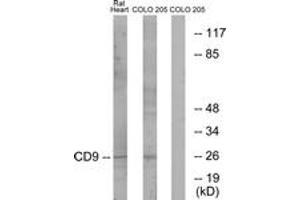 Western Blotting (WB) image for anti-CD9 (CD9) (AA 101-150) antibody (ABIN2889898) (CD9 抗体  (AA 101-150))