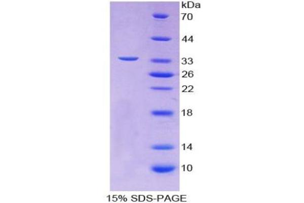 CD42b Protein (AA 19-291) (T7 tag,His tag)