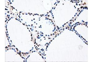 Immunohistochemical staining of paraffin-embedded liver tissue using anti-HDAC10mouse monoclonal antibody. (HDAC10 抗体)