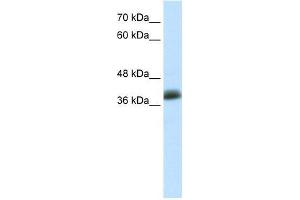 Human MCF-7; WB Suggested Anti-SAP30BP Antibody Titration: 0. (SAP30BP 抗体  (C-Term))