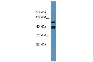 Western Blot showing DDB2 antibody used at a concentration of 1-2 ug/ml to detect its target protein. (DDB2 抗体  (C-Term))
