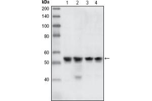 Western blot analysis using CHK1 antibody against HEK293T cells transfected with the pCMV6-ENTRY control (1) and pCMV6-ENTRY CHK1 cDNA (2). (CHEK1 抗体)
