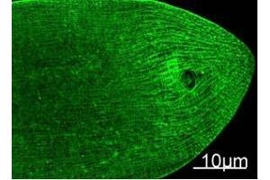 Immunofluorescence Staining of nematode tissue with MYH Mouse mAb (11C2) diluted at 1:100 (Provide by Tsinghua University) . (Myosin Heavy Chain 抗体)