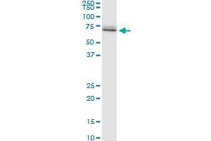 HSPA1A polyclonal antibody (A01), Lot # 070831JCSe. (HSP70 1A 抗体  (AA 1-641))