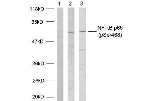 Western blot analysis of extracts using NF-κB p65 (phospho-Ser468) antibody (E011013). (NF-kB p65 抗体  (pSer468))