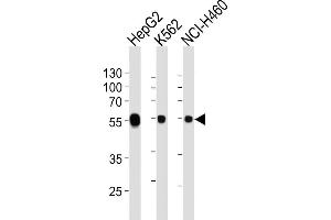 Lane 1: HepG2 Cell lysates, Lane 2: K562 Cell lysates, Lane 3: NCI-H460 Cell lysates, probed with ALDH1A1 (152CT1. (ALDH1A1 抗体)