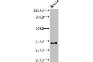 Western Blot Positive WB detected in: Mouse brain tissue All lanes: Cd74 antibody at 3 μg/mL Secondary Goat polyclonal to rabbit IgG at 1/50000 dilution Predicted band size: 32, 25 kDa Observed band size: 32 kDa (CD74 抗体  (AA 56-279))
