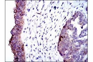 Immunohistochemistry (IHC) image for anti-Alkaline Phosphatase, Liver/bone/kidney (ALPL) antibody (ABIN1845845) (ALPL 抗体)