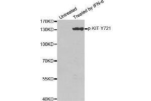 Western blot analysis of extracts from Hela cells, using Phospho-KIT-Y721 antibody. (KIT 抗体  (pTyr721))