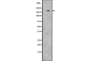 Western blot analysis IRS2 using HUVEC whole cell lysates (IRS2 抗体  (C-Term))