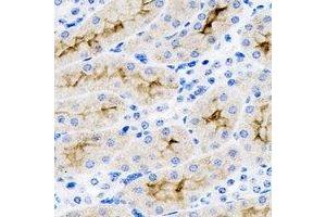 Immunohistochemical analysis of SET staining in mouse kidney formalin fixed paraffin embedded tissue section. (SET/TAF-I 抗体)