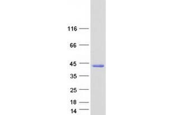 CCDC69 Protein (Coiled coil domain) (Myc-DYKDDDDK Tag)