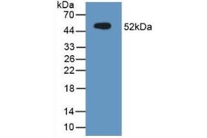 Detection of Recombinant MUC1, Mouse using Polyclonal Antibody to Mucin 1 (MUC1) (MUC1 抗体  (AA 474-630))