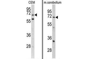 Western blot analysis of GARP antibody (Center) Cat. (LRRC32 抗体  (AA 240-269))