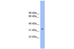 WB Suggested Anti-SLC25A1 Antibody Titration:  0. (Slc25a1 抗体  (Middle Region))