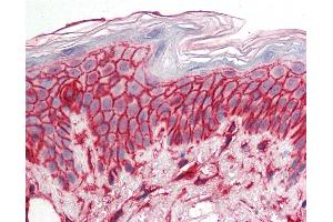 Anti-CD44 antibody IHC staining of human skin. (CD44 抗体)