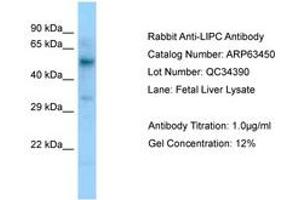 Image no. 1 for anti-Lipase, Hepatic (LIPC) (C-Term) antibody (ABIN6749983) (LIPC 抗体  (C-Term))