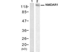 Western blot analysis of extract from mouse brain tissue, using NMDAR1 (Ab-896) Antibody (E021133, Lane 1 and 2). (GRIN1/NMDAR1 抗体)