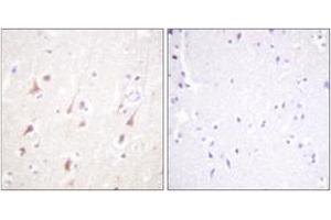 Immunohistochemistry analysis of paraffin-embedded human brain, using IRS-1 (Ab-794) Antibody. (IRS1 抗体  (AA 760-809))