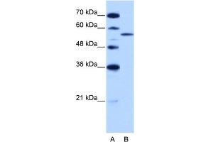 WB Suggested Anti-ZRSR2 Antibody Titration:  2. (ZRSR2 抗体  (C-Term))