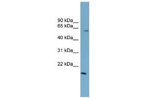 WB Suggested Anti-ZNF83 Antibody Titration:  0. (ZNF83 抗体  (N-Term))