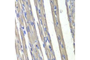 Immunohistochemistry of paraffin-embedded rat heart using AKR1C3 antibody at dilution of 1:100 (400x lens). (AKR1C3 抗体)