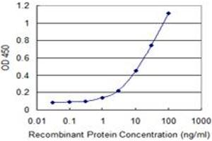 Detection limit for recombinant GST tagged MBD1 is 0. (MBD1 抗体  (AA 415-508))