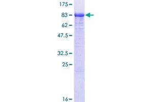 PAPSS1 Protein (AA 1-603) (GST tag)