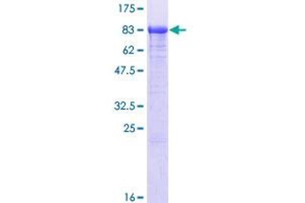 PAPSS1 Protein (AA 1-603) (GST tag)