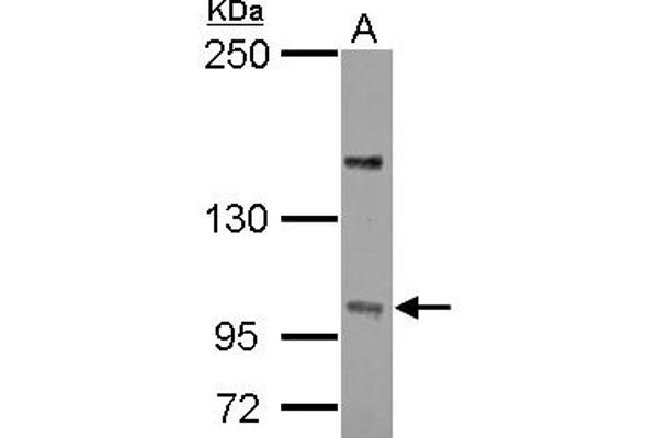 PPP4R4 抗体  (C-Term)