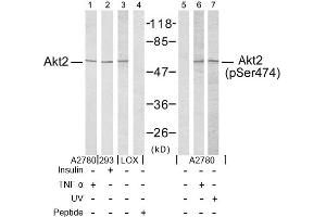 Image no. 2 for anti-V-Akt Murine Thymoma Viral Oncogene Homolog 2 (AKT2) (Ser474) antibody (ABIN197359) (AKT2 抗体  (Ser474))