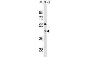 Western Blotting (WB) image for anti-Phosphate Cytidylyltransferase 1, Choline, alpha (PCYT1A) antibody (ABIN3001100) (PCYT1A 抗体)