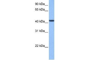 WB Suggested Anti-C8orf34 Antibody Titration: 0. (C8orf34 抗体  (N-Term))