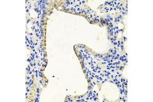 Immunohistochemistry of paraffin-embedded mouse lung using PKN1 antibody (ABIN6003498) at dilution of 1/100 (40x lens). (PKN1 抗体)