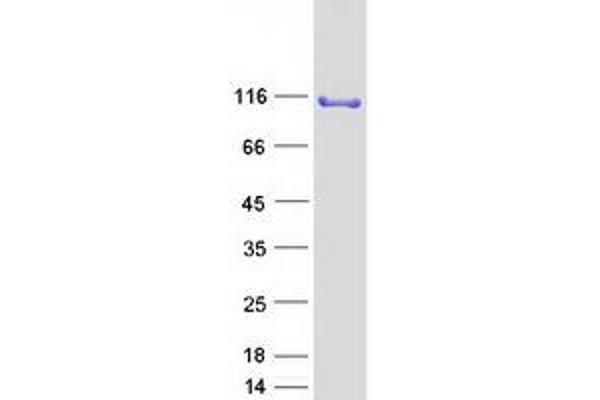 SND1 Protein (Myc-DYKDDDDK Tag)