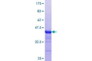 Image no. 1 for Myotubularin Related Protein 3 (MTMR3) (AA 579-674) protein (GST tag) (ABIN1311590) (MTMR3 Protein (AA 579-674) (GST tag))