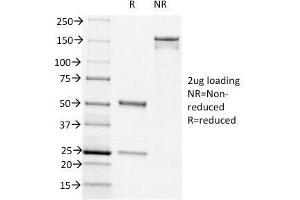 SDS-PAGE Analysis of Purified, BSA-Free CD44v6 Antibody (clone CD44v6/1246). (CD44v6 抗体)