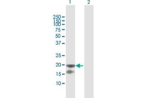 Western Blot analysis of IL1RN expression in transfected 293T cell line by IL1RN MaxPab polyclonal antibody. (IL1RN 抗体  (AA 1-177))