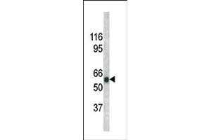 Image no. 1 for anti-Cell Division Cycle 25 Homolog A (S. Pombe) (CDC25A) (pSer279) antibody (ABIN358095) (CDC25A 抗体  (pSer279))