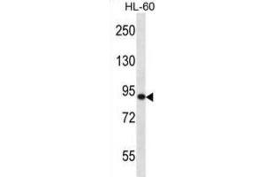 Western Blotting (WB) image for anti-SP140 Nuclear Body Protein (SP140) antibody (ABIN2997006) (SP140 抗体)