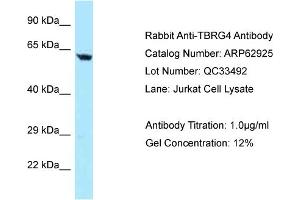 Western Blotting (WB) image for anti-Transforming Growth Factor beta Regulator 4 (TBRG4) (N-Term) antibody (ABIN971851) (TBRG4 抗体  (N-Term))
