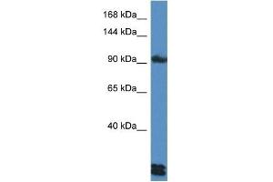 Western Blot showing DSG3 antibody used at a concentration of 1 ug/ml against HepG2 Cell Lysate (Desmoglein 3 抗体  (C-Term))