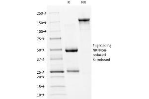 SDS-PAGE Analysis Purified p53 Mouse Monoclonal Antibody (PAb240). (p53 抗体  (AA 14-389))