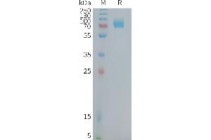 Human CD22(417-678) Protein, hFc Tag on SDS-PAGE under reducing condition. (CD22 Protein (AA 417-678) (Fc Tag))