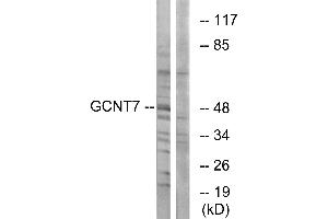 Immunohistochemistry analysis of paraffin-embedded human ovary tissue using GCNT7 antibody. (GCNT7 抗体)