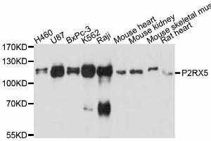 Western blot analysis of extracts of various cell lines, using P2RX5 antibody (ABIN5998432) at 1:3000 dilution. (P2RX5 抗体)
